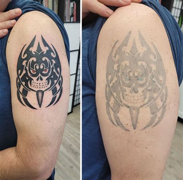 Can I fly after a tattoo?