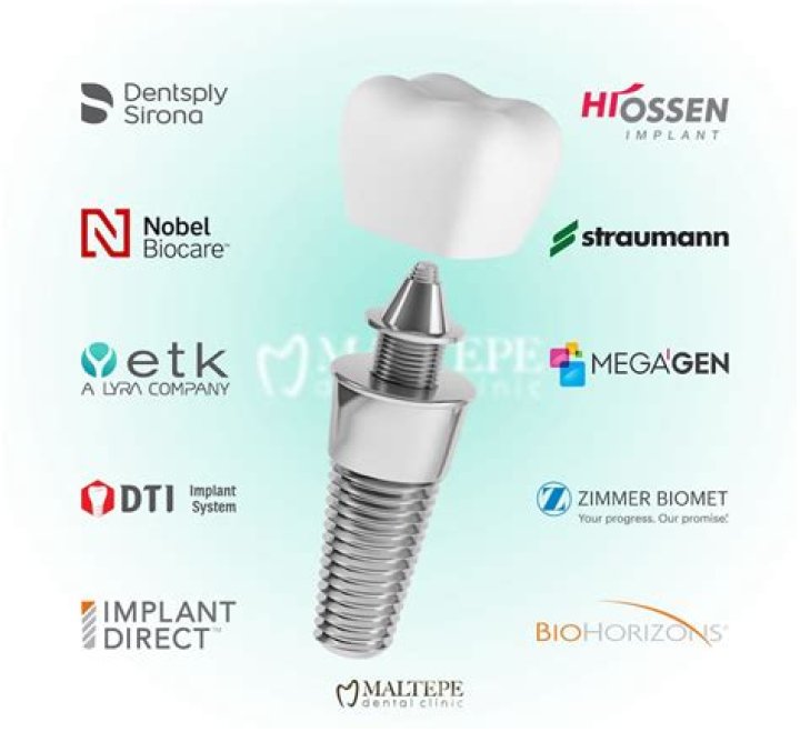 Can you have an MRI if you have a dental bridge?