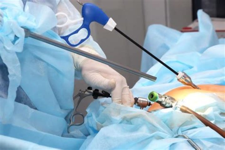 Can you walk after laparoscopy?