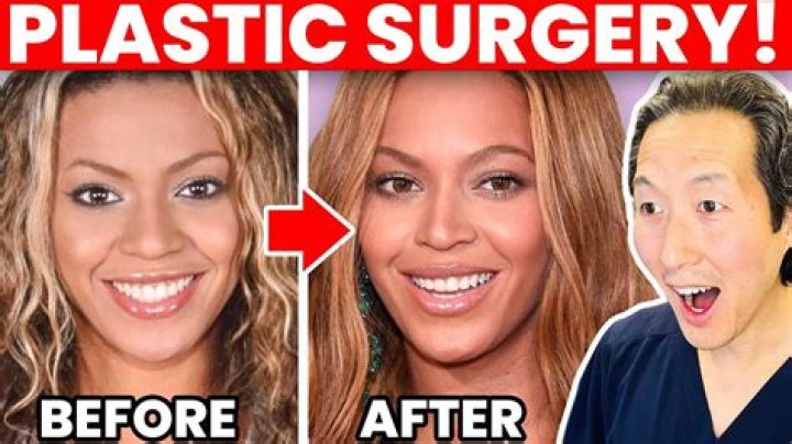 Did Beyonce ever have braces?