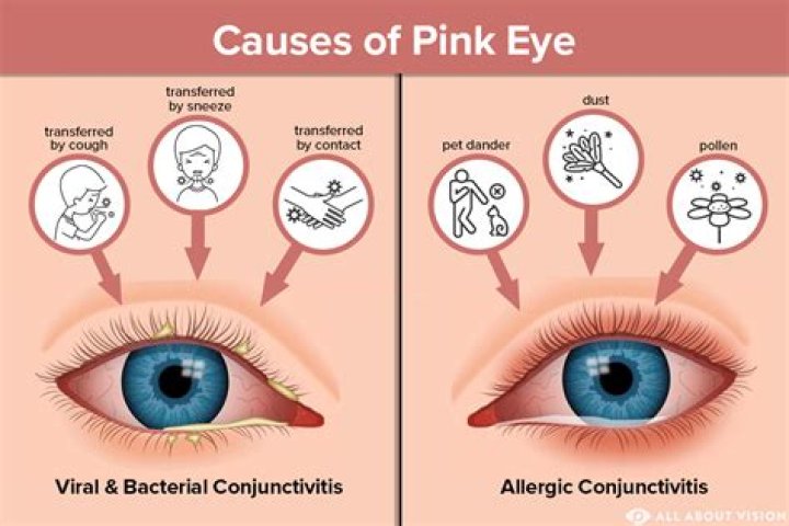 How do you get rid of pink bacteria?