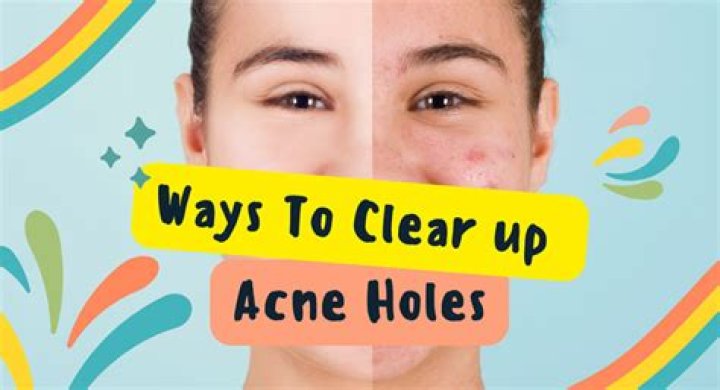 What causes holes in face?