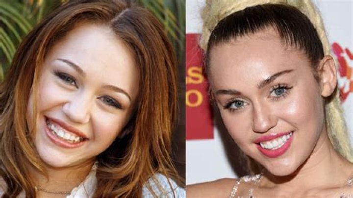 What do celebrities use to look younger?