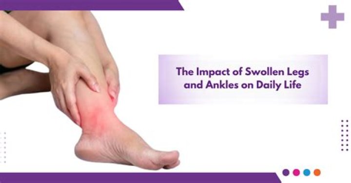 What medications can cause swollen ankles?