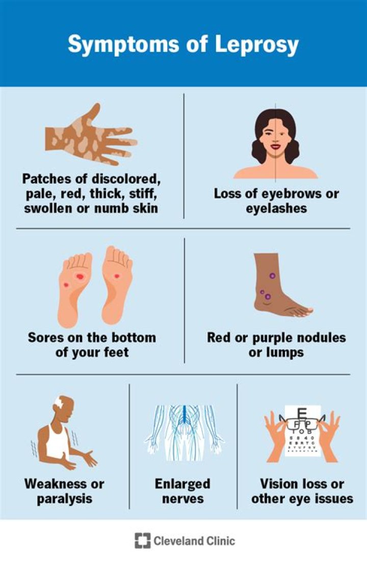 Where is leprosy most likely found?