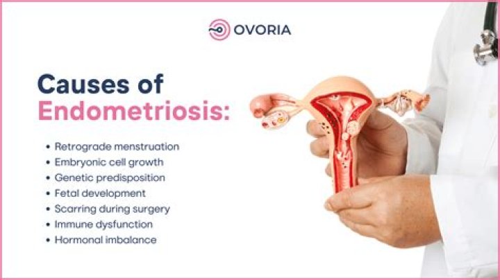 Why does exercise help endometriosis?